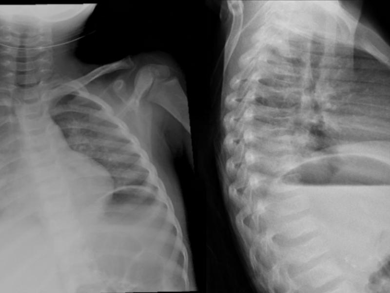 From the Archives: What's the Diagnosis? By Dr. Sandhya Ashokkumar