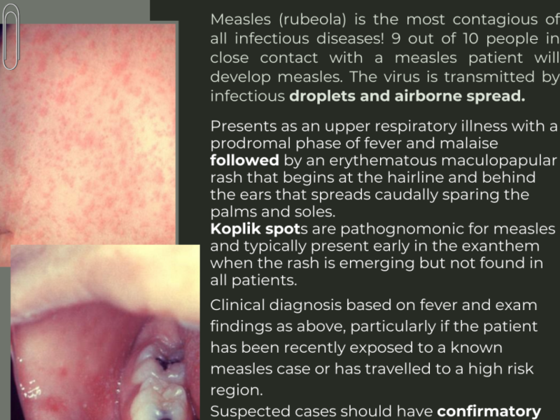 Measles Part 1: Identification with Drs. Edward Guo and Simon Sarkisian