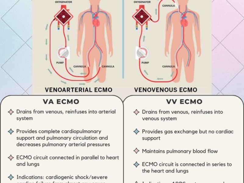 Basics of ECMO with Dr. Rebecca Fenderson