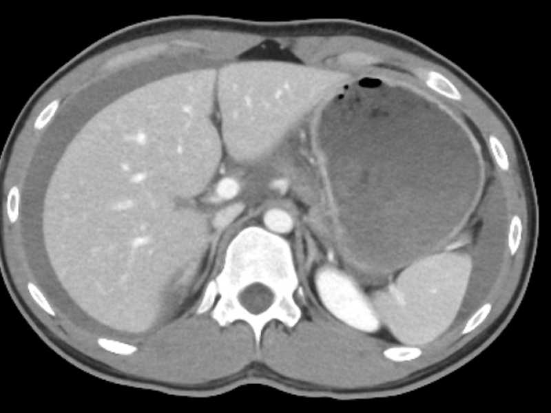 What is the Diagnosis?