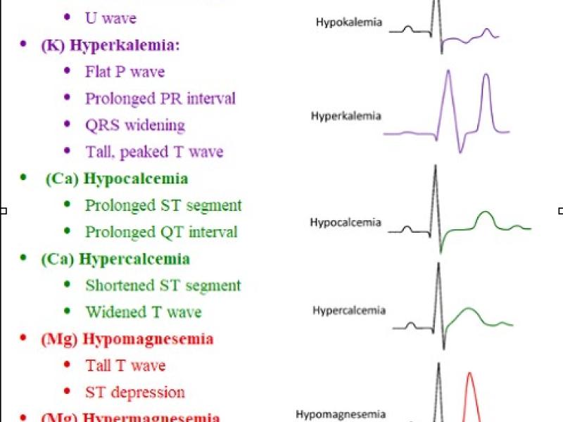 Board Review by Dr. Hilbmann (Edited by Dr. Parikh)