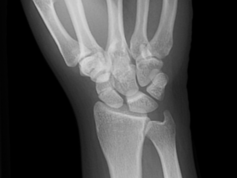 What's the Diagnosis? By Dr. Erica Schramm