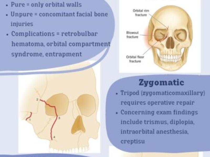 Facial Fractures with Dr. Erica Westlake