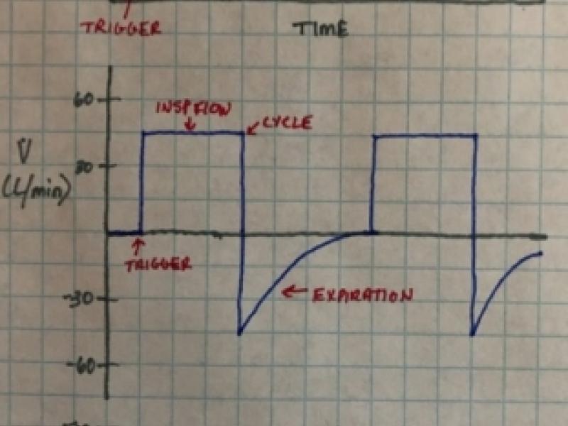 Leave the sedation alone!  Diagnosis and management of patient-ventilator asynchrony