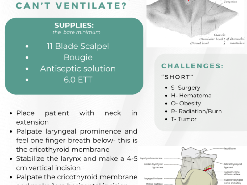Cricothyrotomy with Dr. Marrone