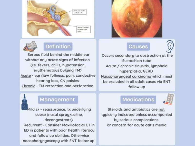 Otitis Media with Effusion by Dr. Sean Coulson