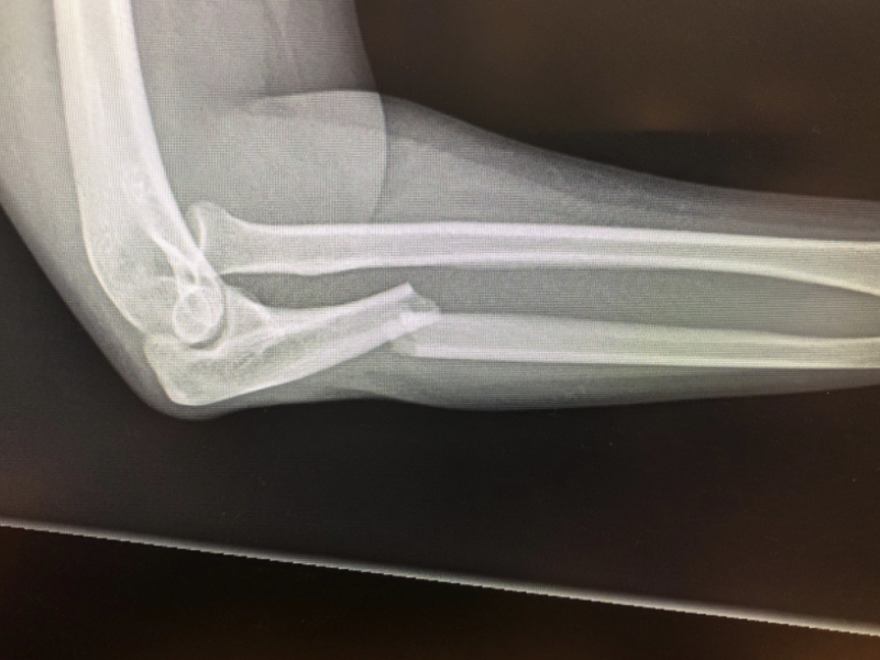 What's the diagnosis?  By Dr. Michael Tom