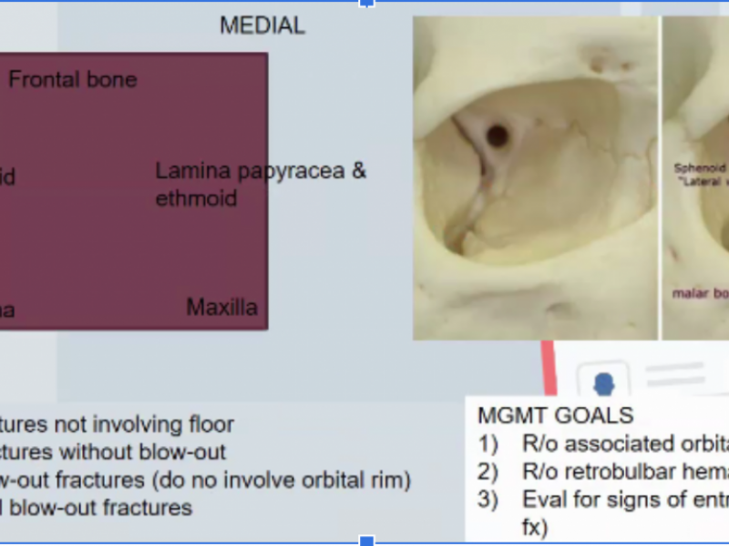 #EMConf: Facial Fractures
