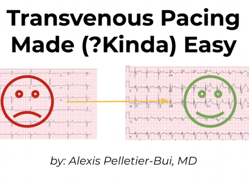 Transvenous Pacing