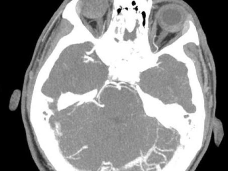 What's the Diagnosis? By Dr. Katie Selman