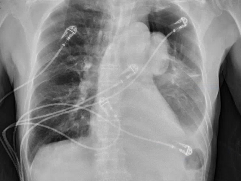 What's the Diagnosis?  By Dr. Sarab Sodhi