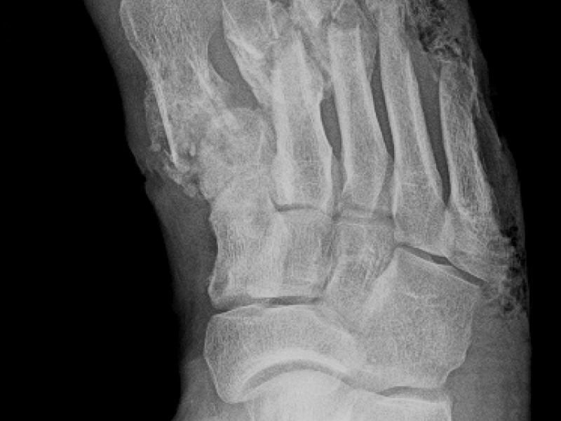 What's the Diagnosis? By Dr. Lauren Murphy