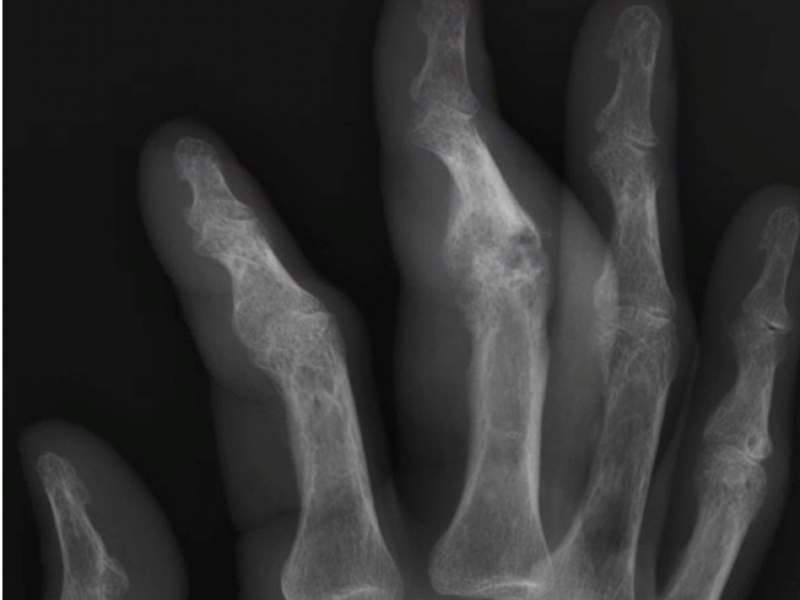 What's the Diagnosis? By Dr. Michael Tom