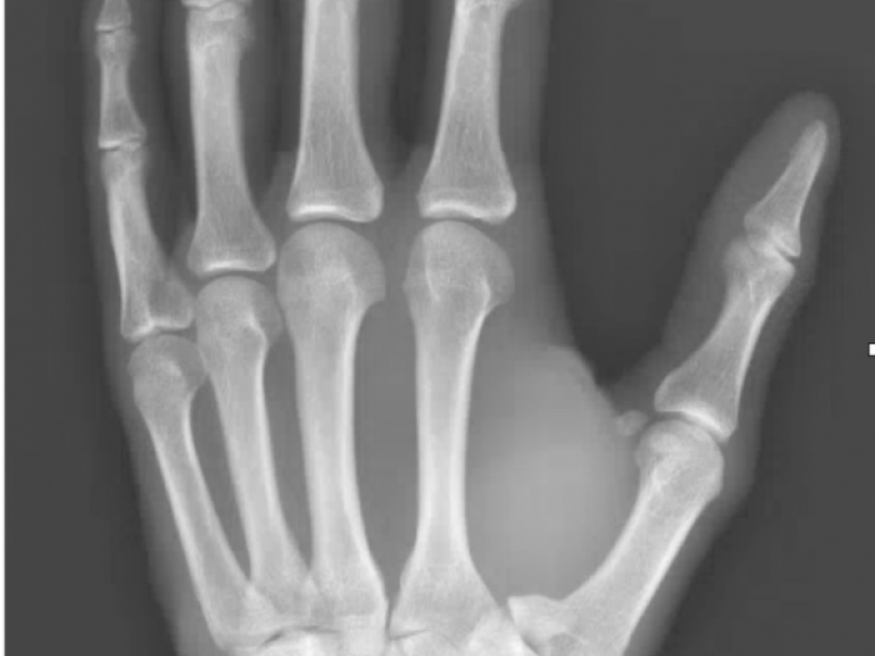 What's the Diagnosis? By Dr. Chris Smith