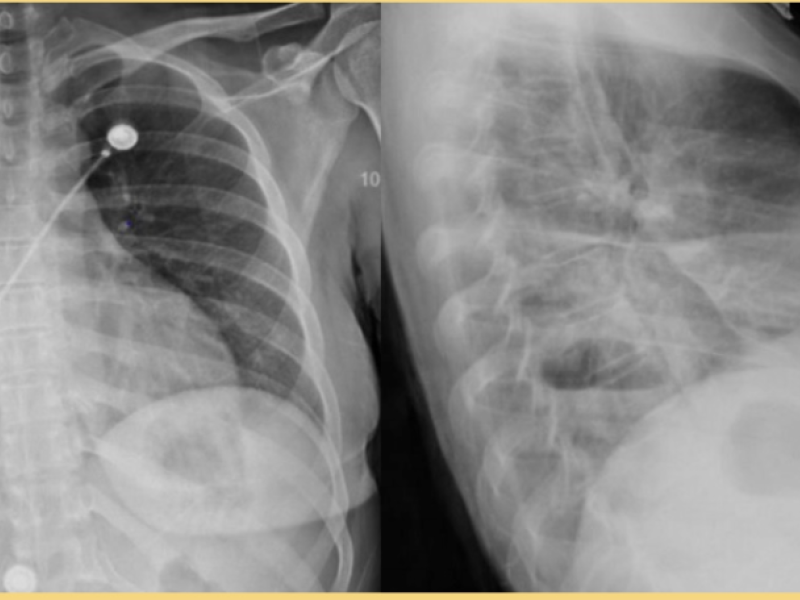 From the Archives: What's the Diagnosis? By Dr. Becca Fieles