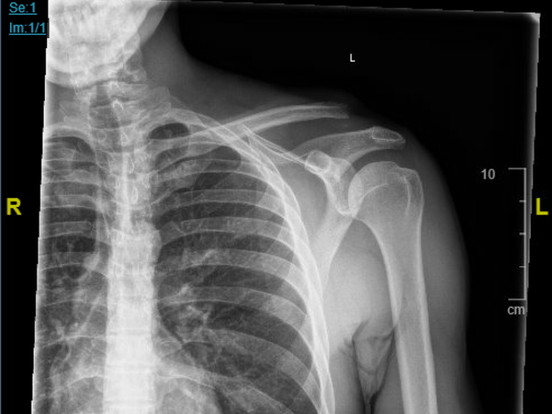 Board Review by Dr. Edward Guo (Edited by Dr. Parikh)