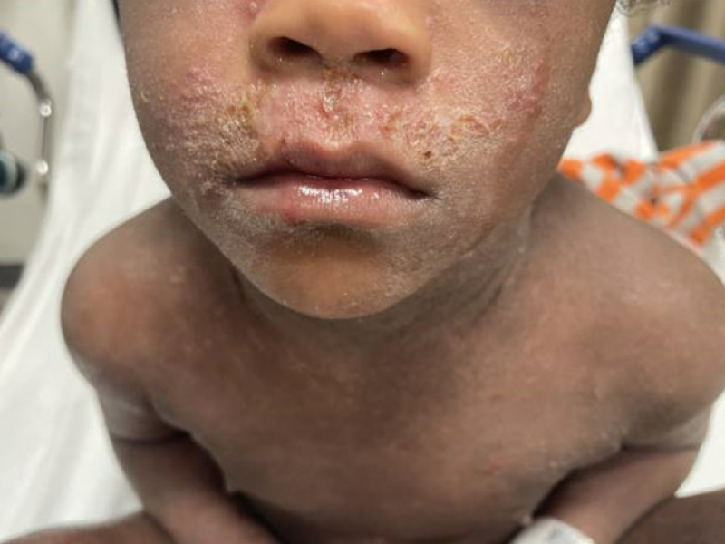 From the Archives: What's the Diagnosis? By Dr. Katie Selman