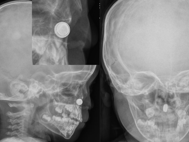 What's the Diagnosis? By Dr. Edward Guo