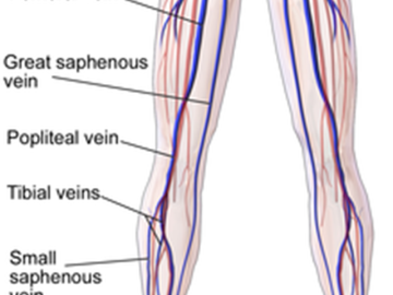 Board Review by Dr. Guo (Edited by Dr. Parikh)