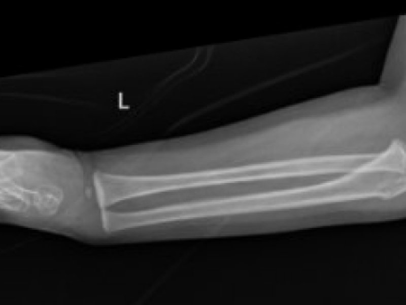 What's the Diagnosis? By Dr. Shivani Talwar