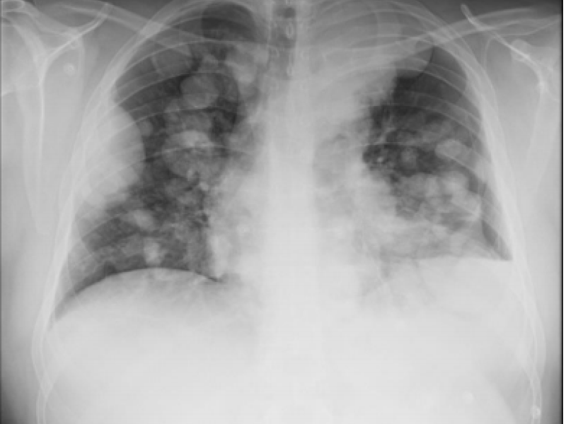 From the EMDaily Archives: What's the Diagnosis? By Dr. Eric Chavis