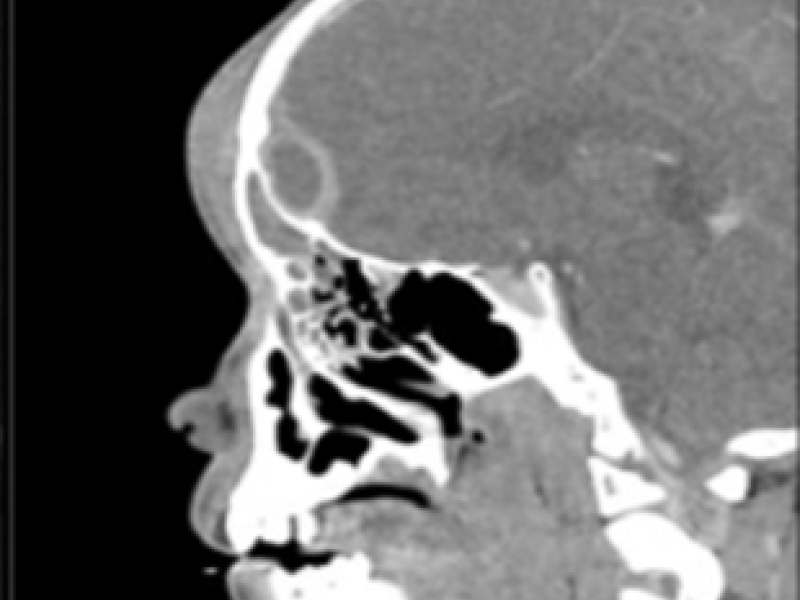 What is the Diagnosis?