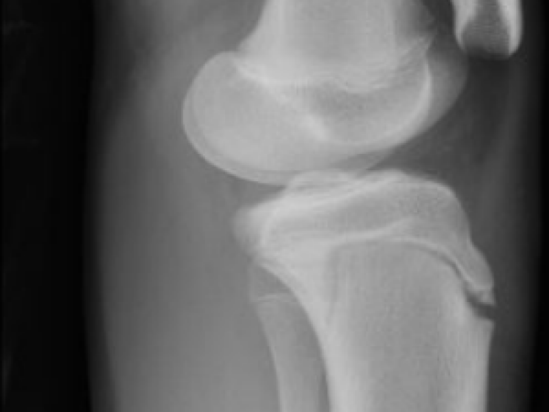 What's the Diagnosis? By Dr. Loran Hatch