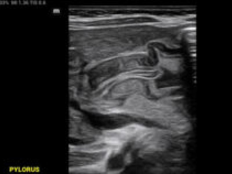 What is the Diagnosis? By Dr. Cevallos