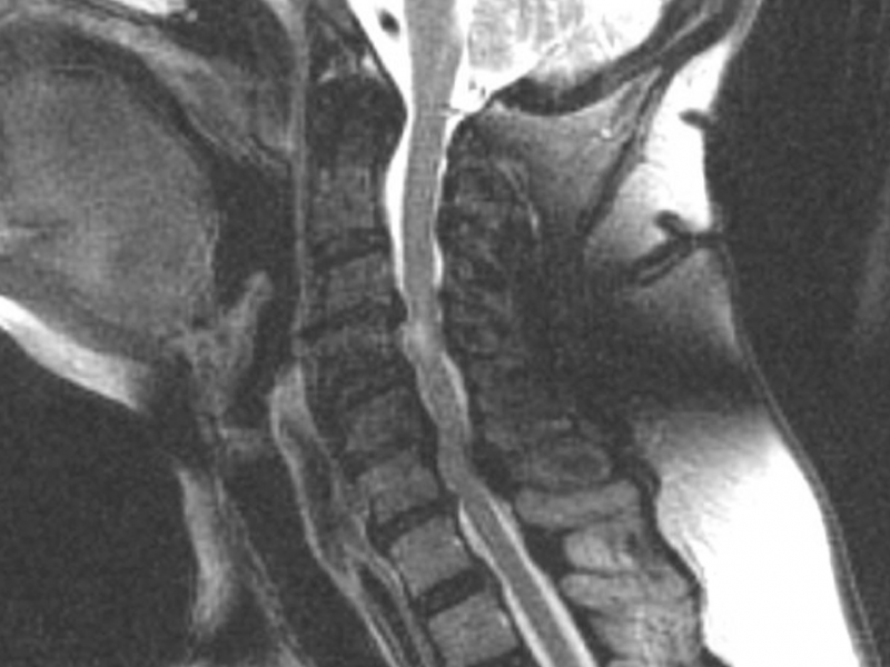 What's the Diagnosis? (the Critical Care edition) Case by Dr. Kim Chavez