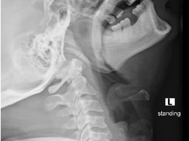 What's the Diagnosis? By Dr. Lauren Murphy