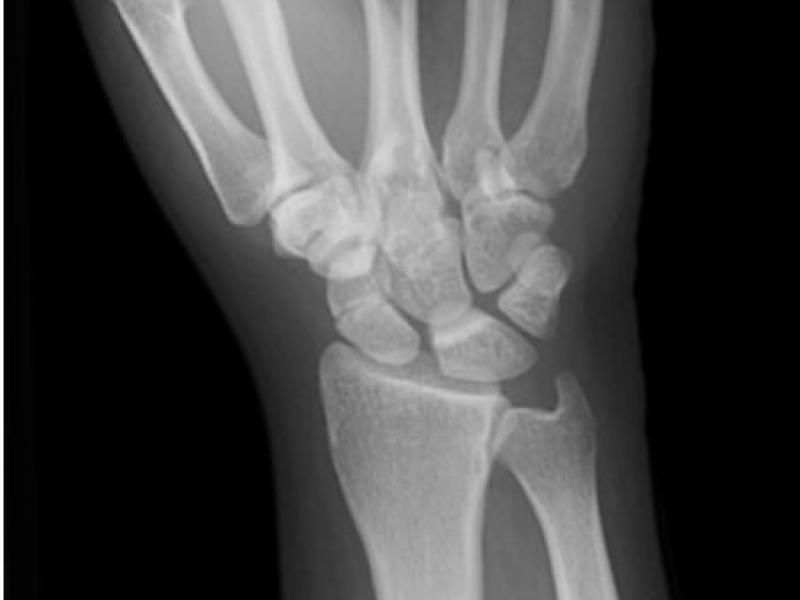 What's the Diagnosis? By Dr. Erica Schramm